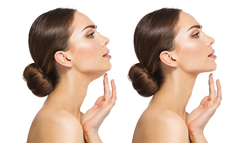 Como combater e redefinir o contorno facial